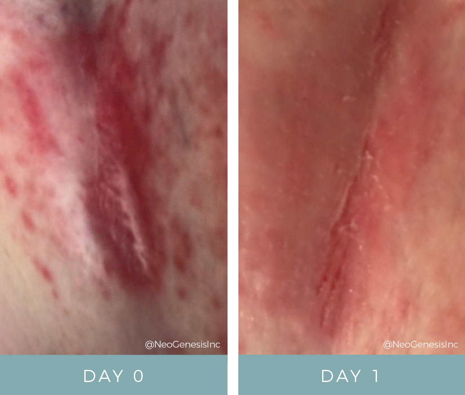Oncology Before + Afters - Chemotherapy Rash