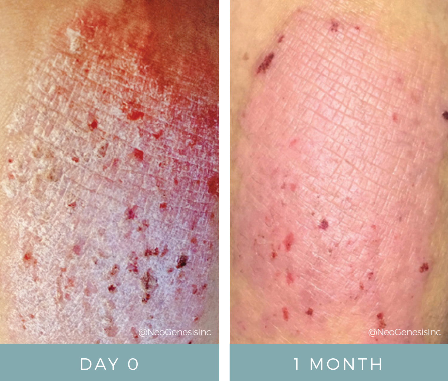 Before & After - Dermatitis