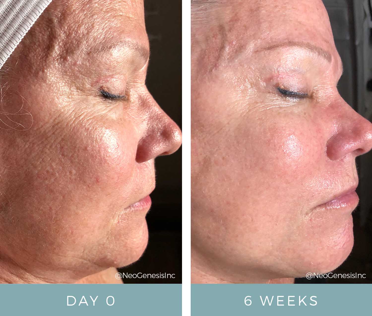 Before + After - Aging Skin