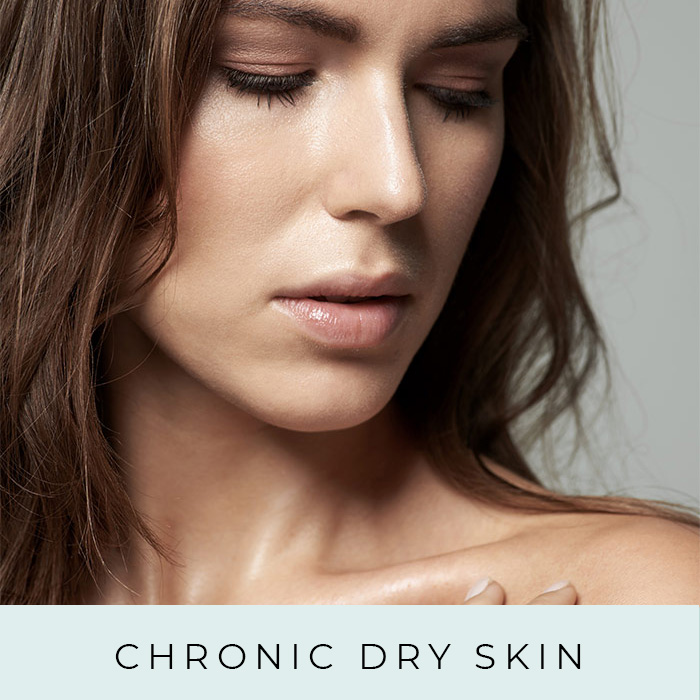 Products for Chronically Dry Skin