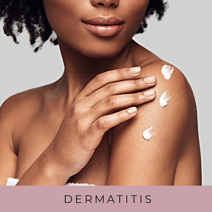 Products for Dermatitis