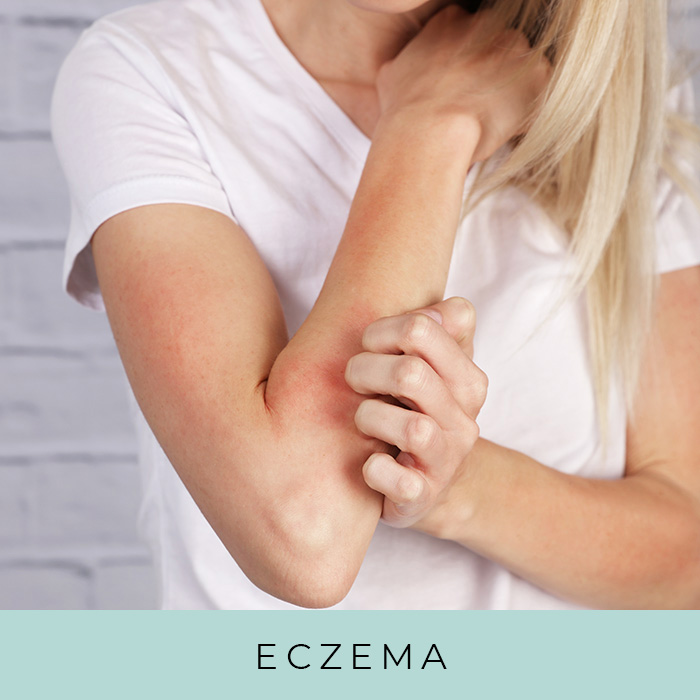 Products for Eczema