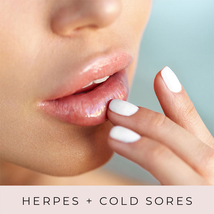 Products for Herpes + Cold Sores