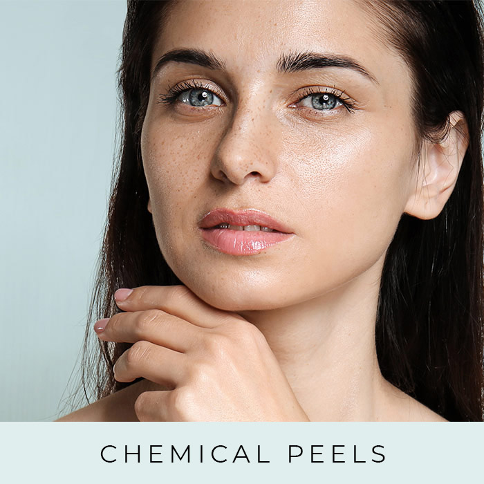 Products for Chemical Peels