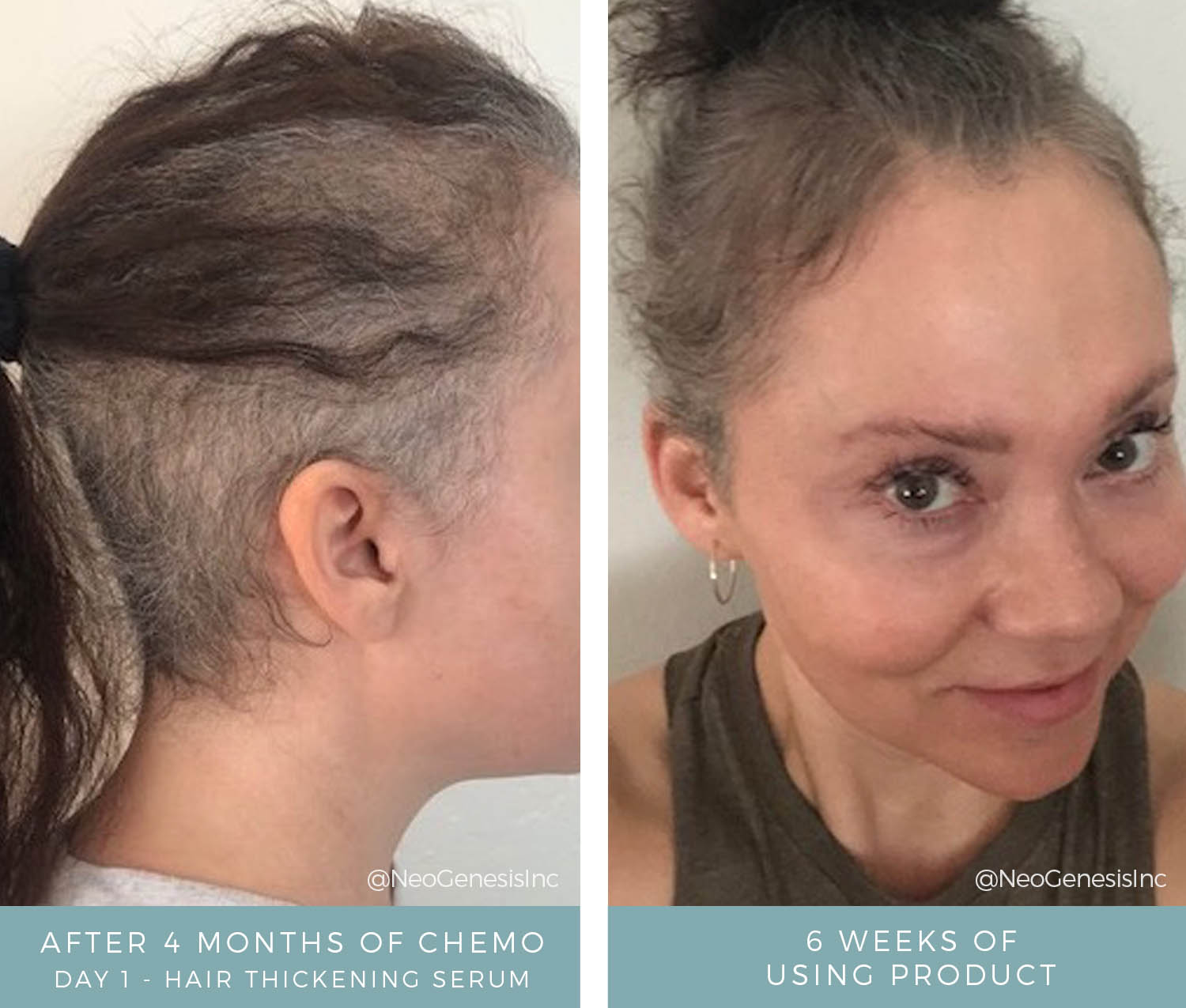 Before + After - Chemotherapy - Hair + Lash + Brow