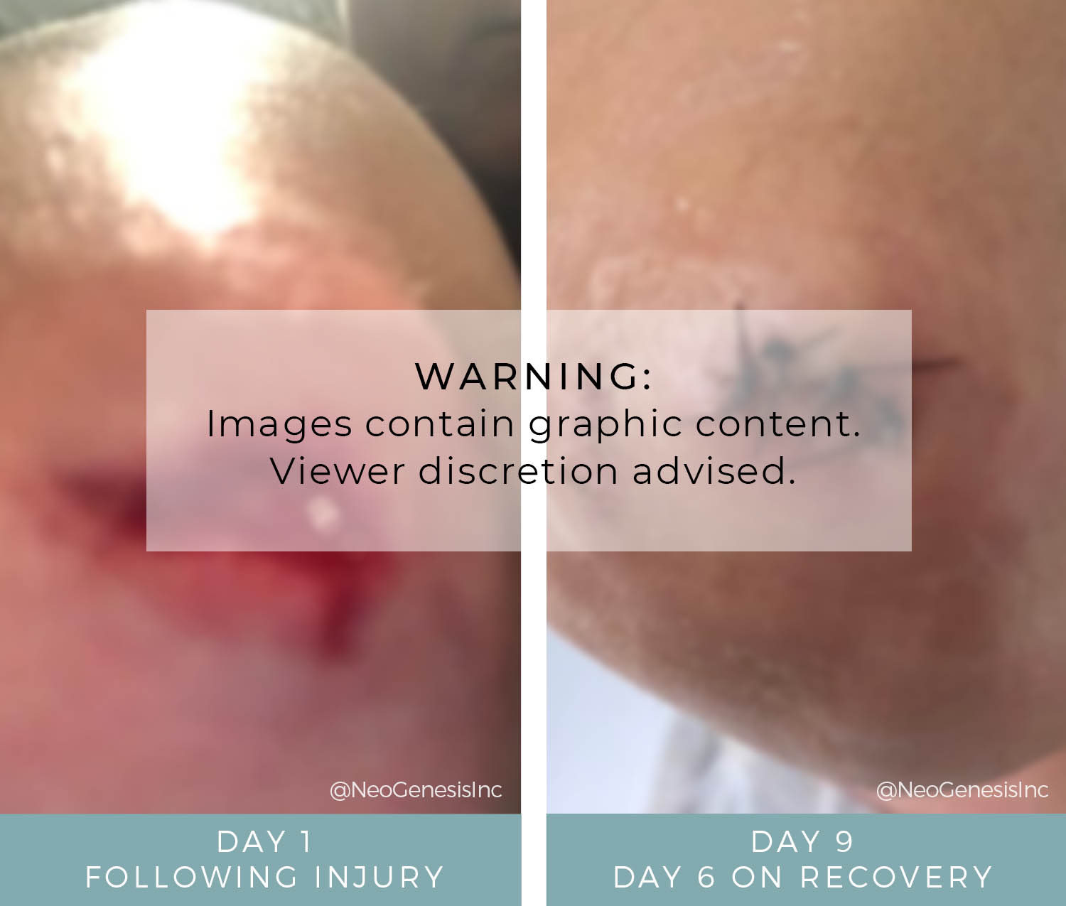 Before + After - Open Wound Care
