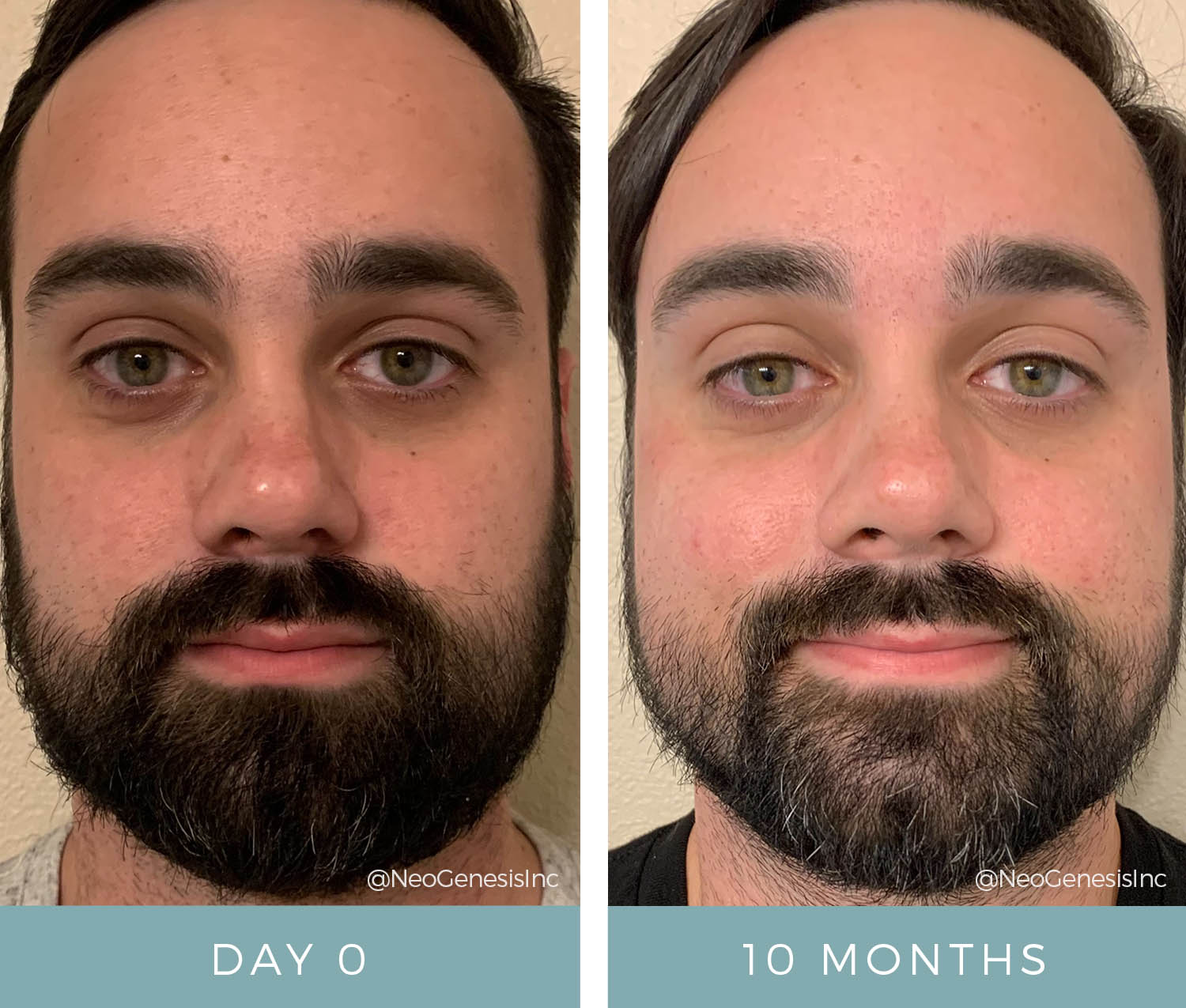 Before + After - Aging Skin - Male