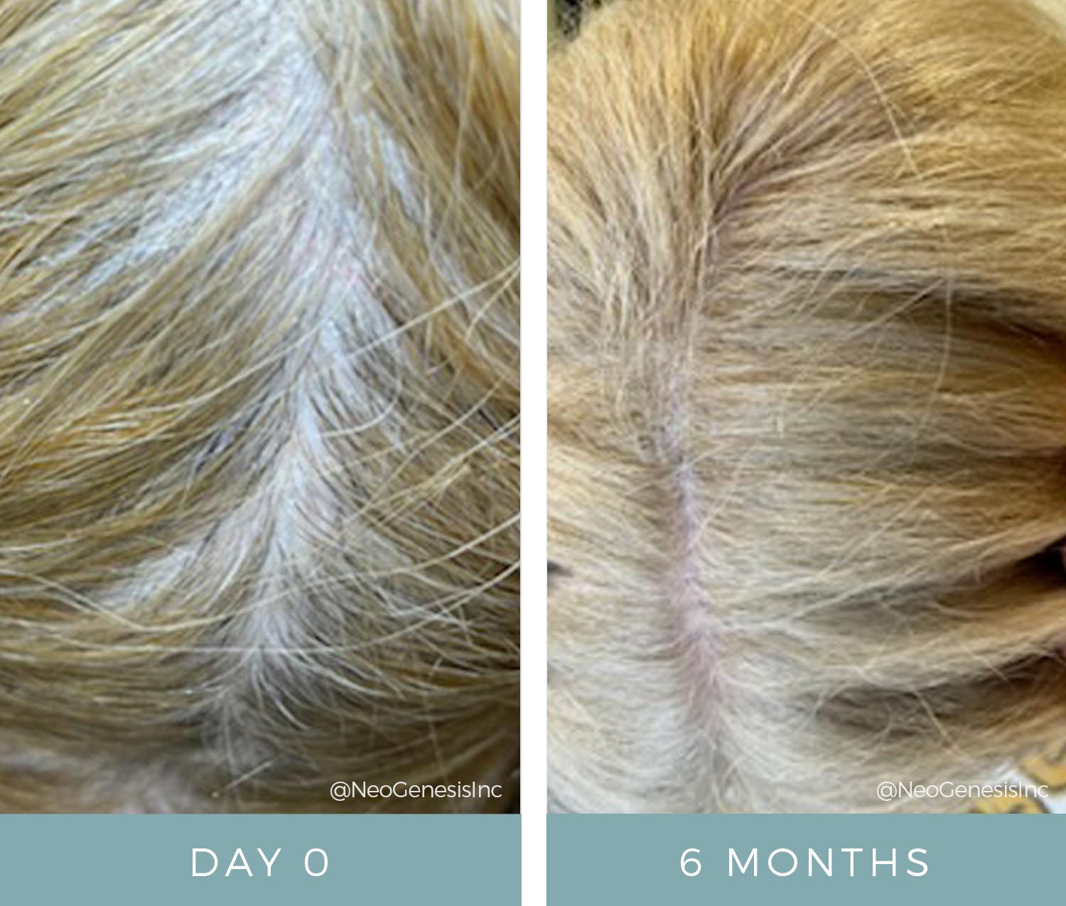 Hair Loss from Anesthesia - Before + After