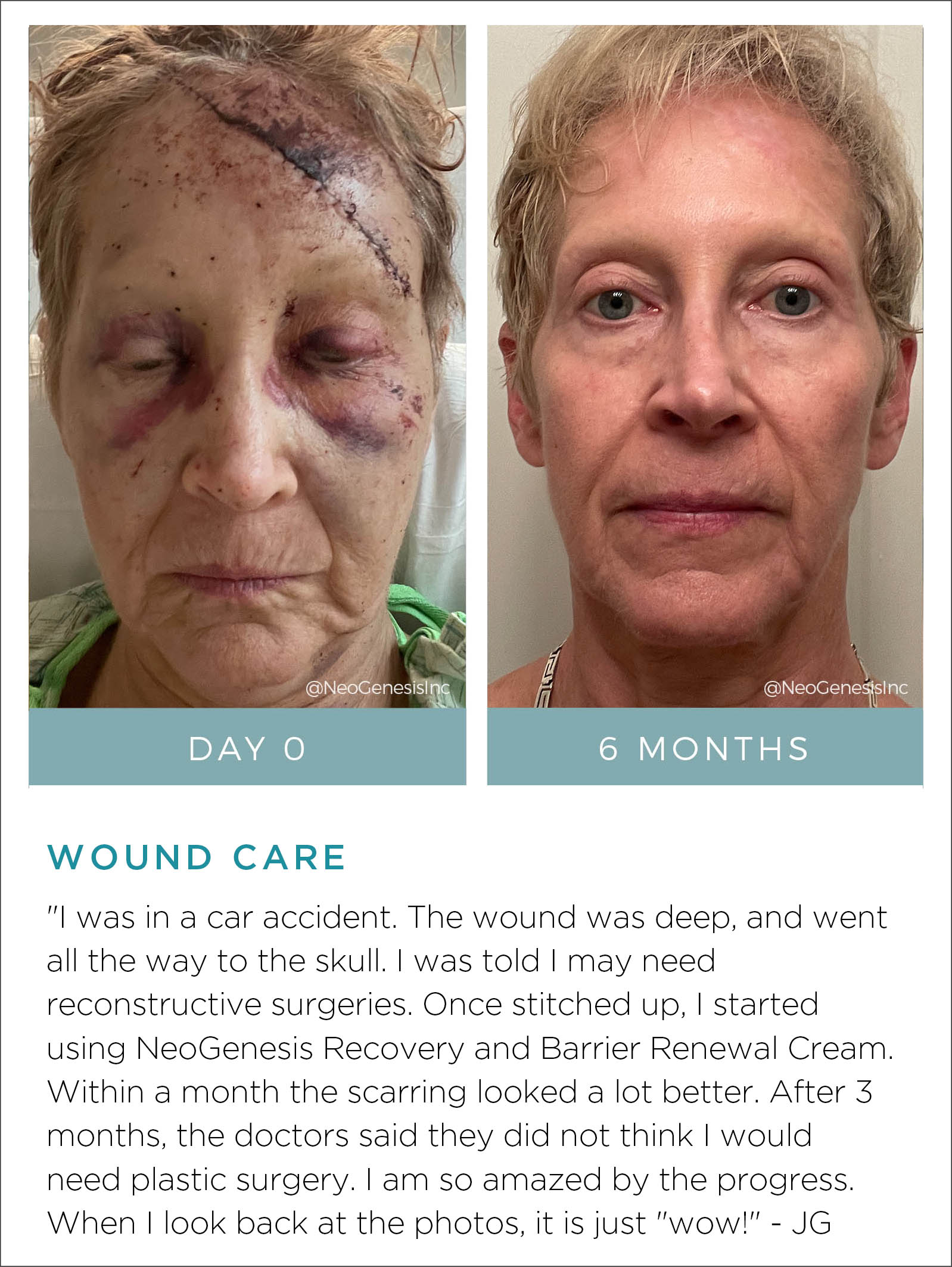 Wound Care Before + After